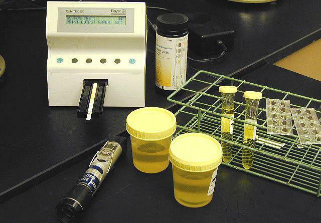 chemical toxicological examination of urine