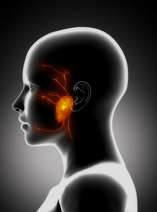 parotid salivary gland inflammation symptoms