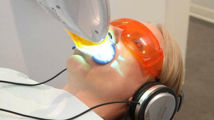 laser teeth whitening price