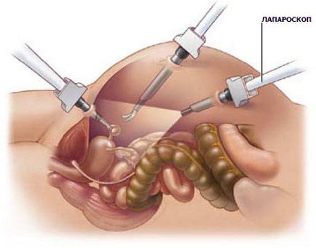 ], klinikk for endoskopisk og minimal invasiv kirurgi