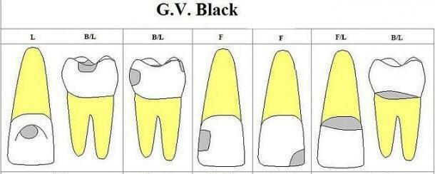 black classification
