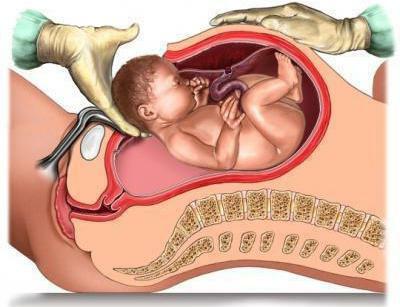 tripe on the uterus during pregnancy