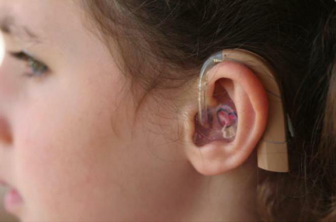 hearing restoration in children
