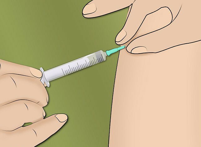Lidase injections