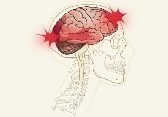 førstehjælp i tilfælde af craniocerebral trauma