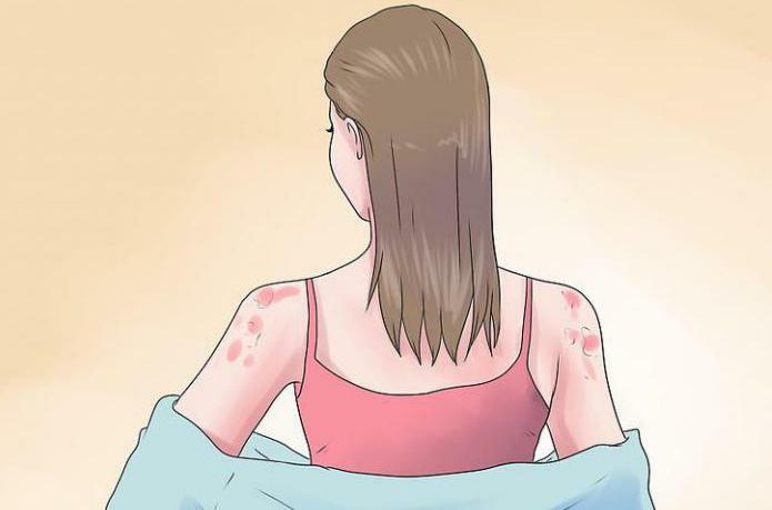 allergy spots on the neck