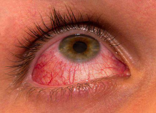 eye allergen