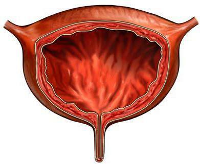 Rupture of the bladder