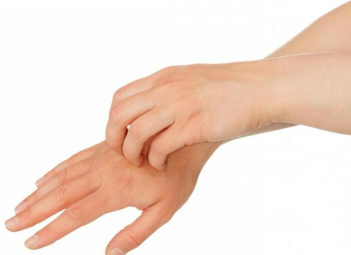 redness and itching on hands treatment