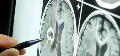 brain echoencephalography in children