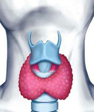 acute thyroiditis