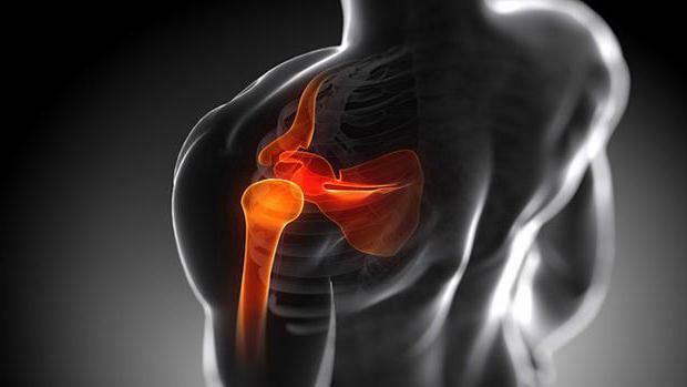arthrosis of the shoulder joint treatment of gymnastics
