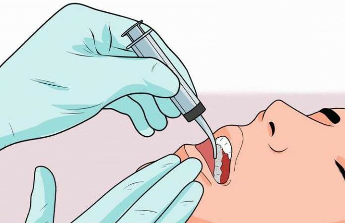 alveolitis tooth treatment at home