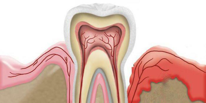 classification of periodontal diseases