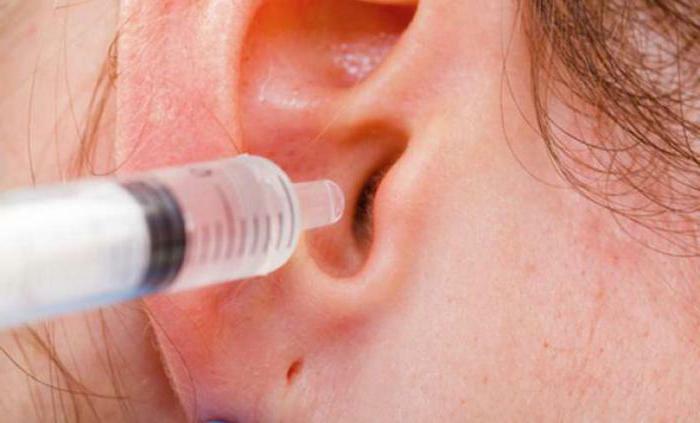 how to remove the ear plug at home