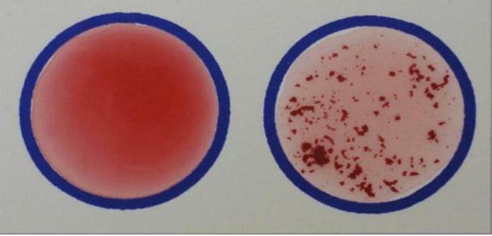 schéma de transfusion sanguine par groupes