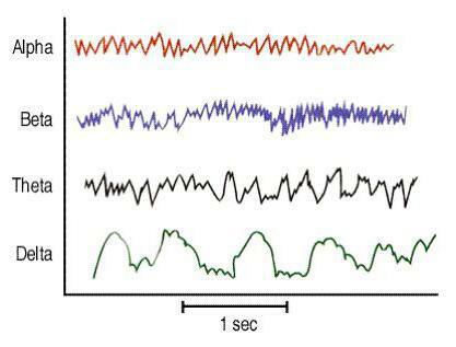 alpha brain rhythm