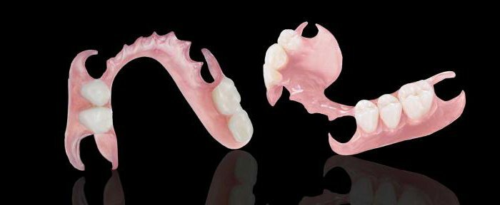 nylon prosthesis with partial absence of teeth reviews