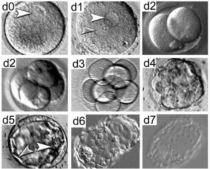 transfer of the blastocyst  class="if" height="212" src="/files/439/1729141/2432547.jpg" width="300">  </p>  <h2> Blastocyst transfer in IVF: a bit of </h2>  <p> theory In the period of preparation for in vitro fertilization, the body of a woman undergoes very heavy loads. Through medications, the ovaries are stimulated. They grow not one or two, but a lot of dominant follicles. Shortly before ovulation, they are extracted using modern medical methods. Further, in special conditions, they are fertilized by male cells. </p>  <p> A few years ago, doctors were confident that it was necessary to attach three-day embryos. This opinion was formed because a day later most of the cells simply died. Laboratory assistants and reproductologists could not create the appropriate conditions for their survival. Now with the help of new techniques and materials, blastocyst transfer can be carried out. This is a set of cells, which for five days developed in a test tube. </p>  <h2> Pros and Cons of </h2>  <p> Most doctors, geneticists and reproductologists say that blastocyst transfer is about 60 percent of success. While three-day embryos are likely to gain a foothold in the genital organ by only 30 percent. Why is this distinction? Everything is very simple. </p>  <p> Blastocyst after the transfer is ready to immediately infiltrate the endometrium, that is, implant. Three-day embryos with natural fertilization are still in the fallopian tube. To get to the uterus, they need an average of two days. That is why in such situations there is a risk of failure. </p>  <p> The undoubted advantage of blastocyst transfer is a high probability of a successful outcome. However, manipulation has its drawbacks. Some laboratories are not able to create conditions for the survival of embryos in this state. Therefore, some of them die on the fourth day. Reproduction specialists note that the same likelihood of survival would have been in the uterine cavity, if the three-days were planted. Blastocyst is a set of cells, ready to hatch from its shell and implanted into the uterus. At this stage of embryo development, there are more chances to detect any deviations. </p>  <p>  <img itemprop="image" alt=