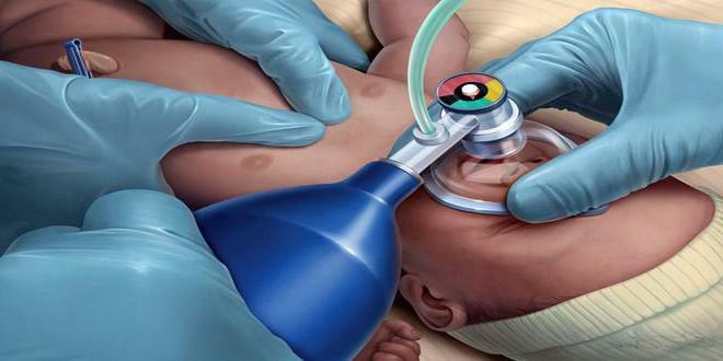 resuscitation of a newborn