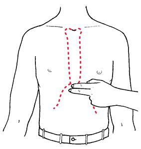 o hamstring do sternum dói