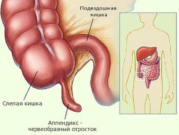 príznaky preosievania sytkovského