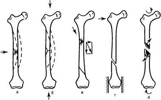 humerus anatómia fotografie