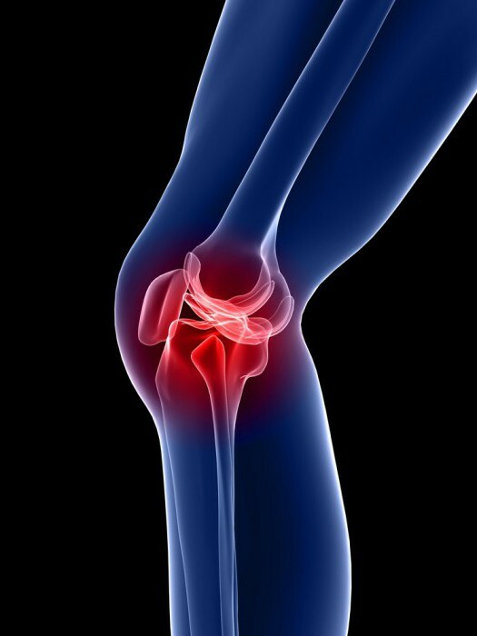 knee joint arthrosis
