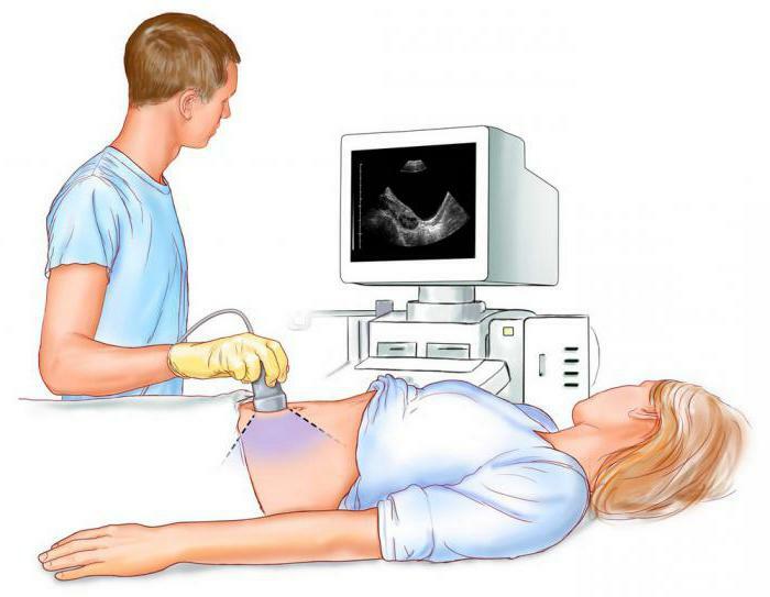 tubal pregnancy as a tubal abortion