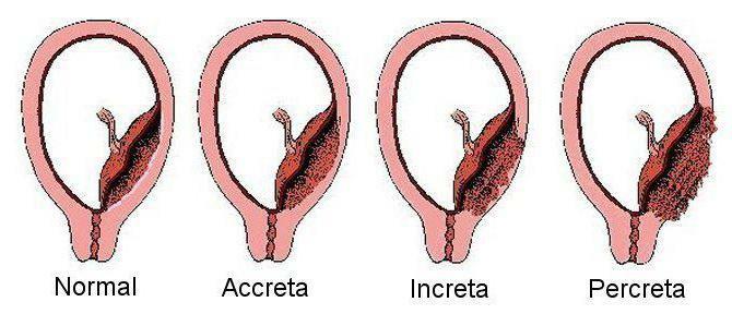 the bottom of the uterus