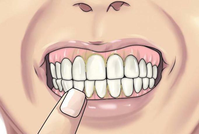 bleeding gums when brushing teeth