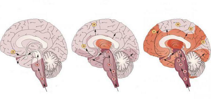 folk treatment of Parkinson