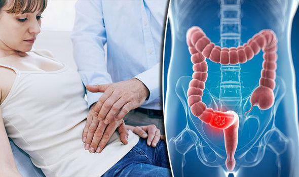 sigmoid colon metastases