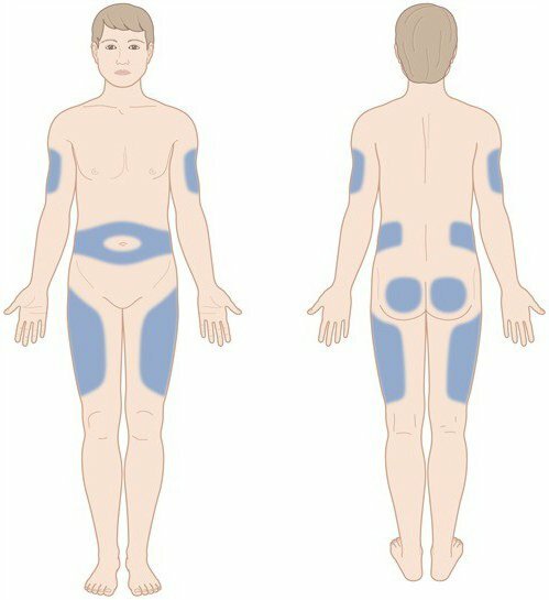 teknik for insulinindføringsalgoritme