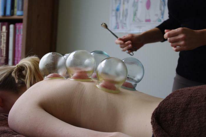 recenzii hijama