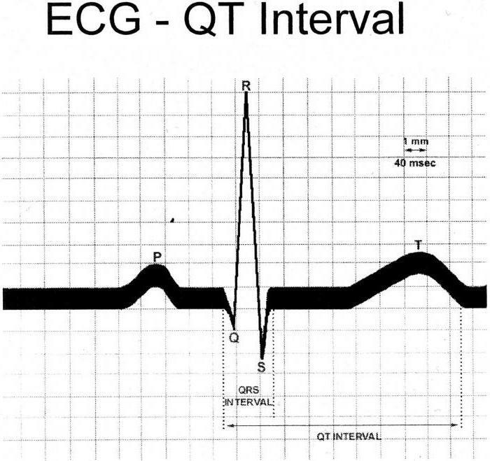 predĺžený intervalový syndróm qt liečba