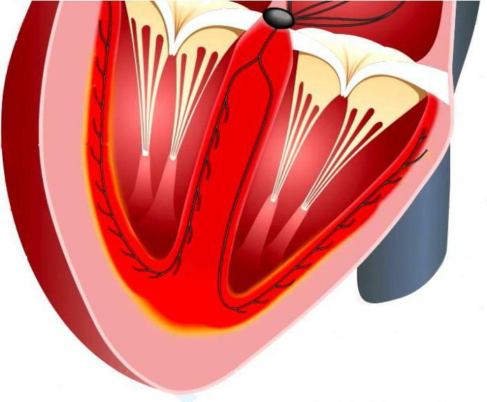 القلب هيكل النخاع عضلة القلب عضلة القلب