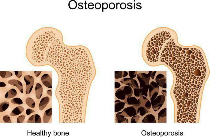 hvilket calciumpræparat absorberes bedre af kroppen