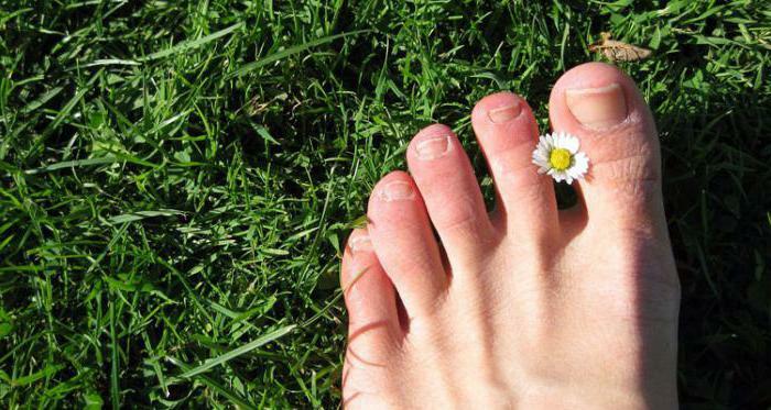Inexpensive remedies for nail fungus on legs