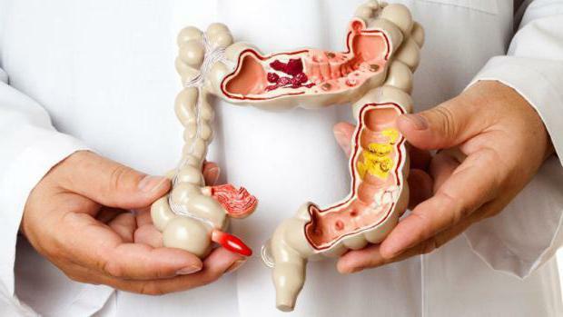 syndrome of the small intestine photo