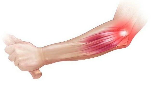 muscles of the elbow joint anatomy