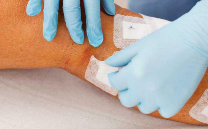 intravenous laser irradiation of blood