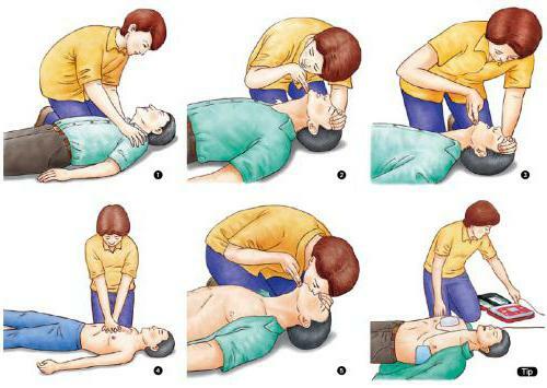 carrying out the CPR algorithm