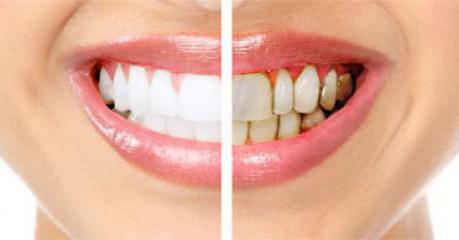 Disease of teeth and gums