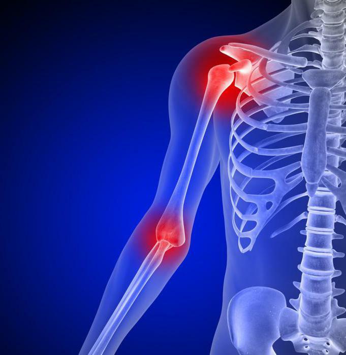 pain in the arm in the shoulder joint