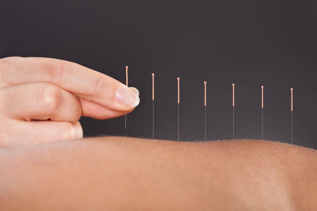 Acupuncture in the center of Chinese medicine