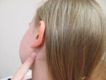 application of ear drops