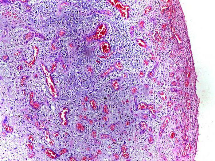 the third stage of inflammation