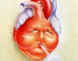 cardiac decompensation
