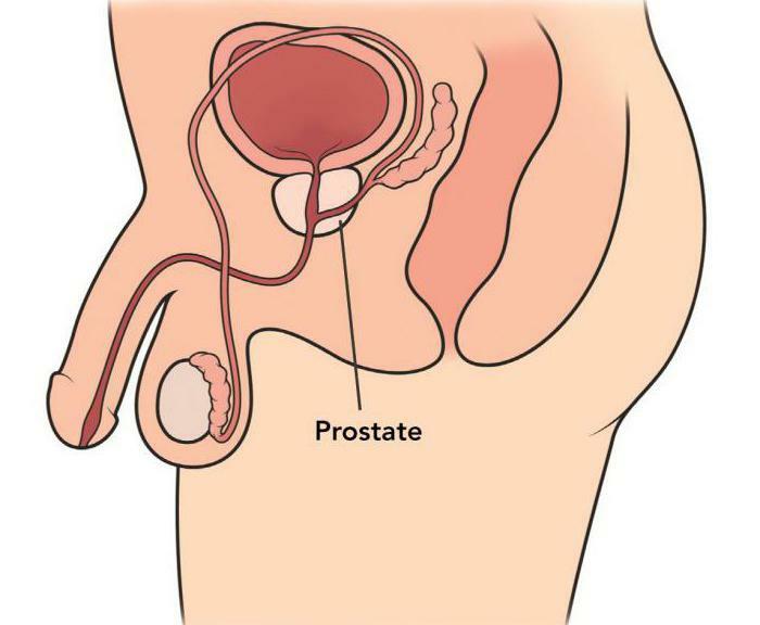 prostate this